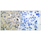 Immunohistochemistry - Anti-FGFR3 Antibody (C0192) - Antibodies.com