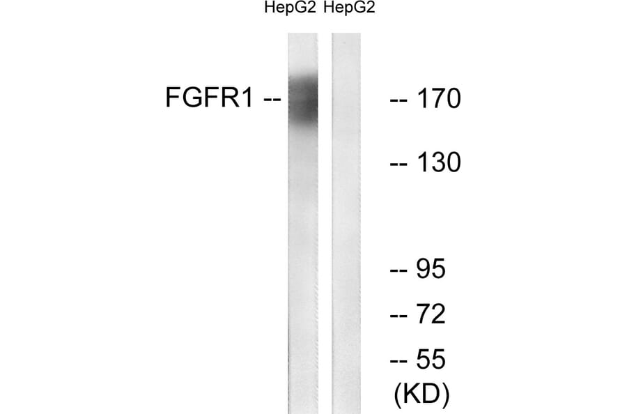 Western Blot - Anti-FGFR1 Antibody (B0480) - Antibodies.com