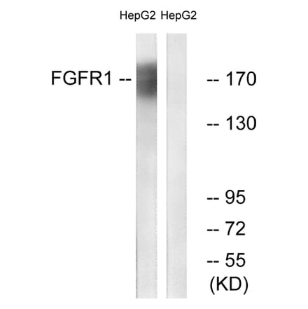 Western Blot - Anti-FGFR1 Antibody (B0480) - Antibodies.com