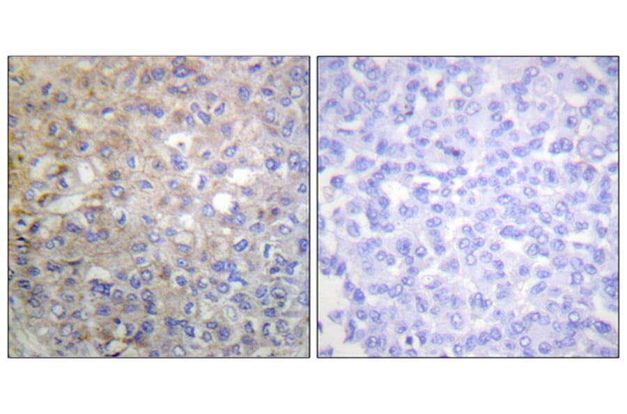 Immunohistochemistry - Anti-FGFR1 Antibody (B0480) - Antibodies.com
