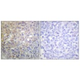 Immunohistochemistry - Anti-FGFR1 Antibody (B0480) - Antibodies.com
