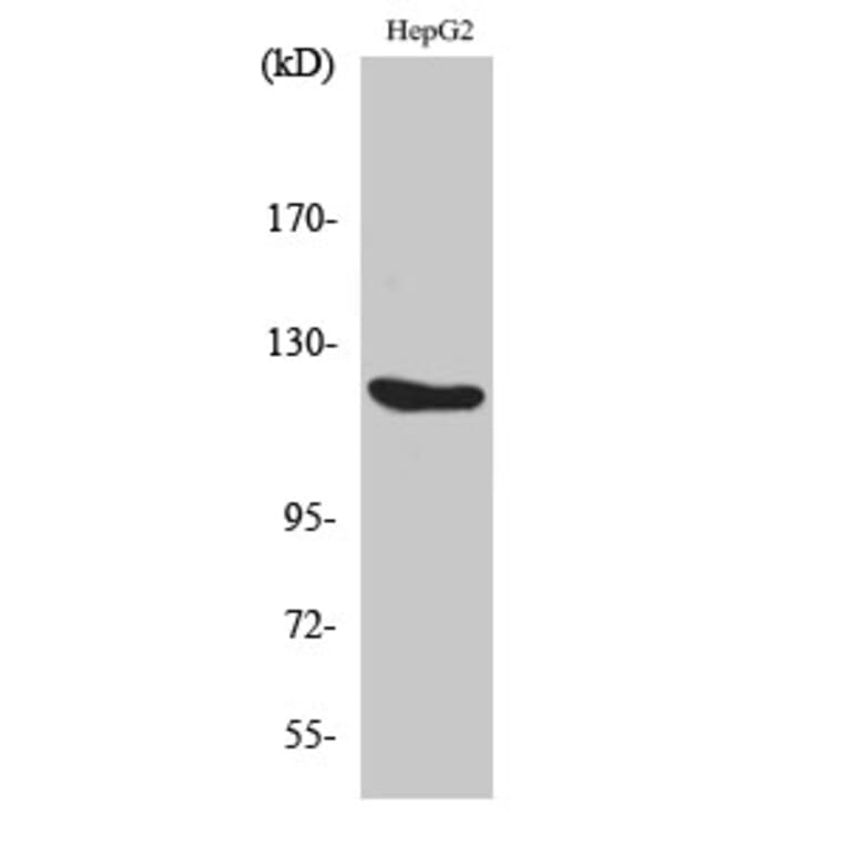 Western Blot - Anti-FGFR1 Antibody (B0480) - Antibodies.com