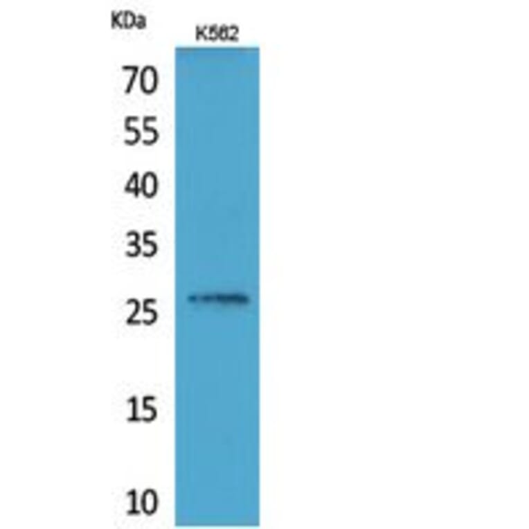 Western Blot - Anti-FGF16 Antibody (C30083) - Antibodies.com