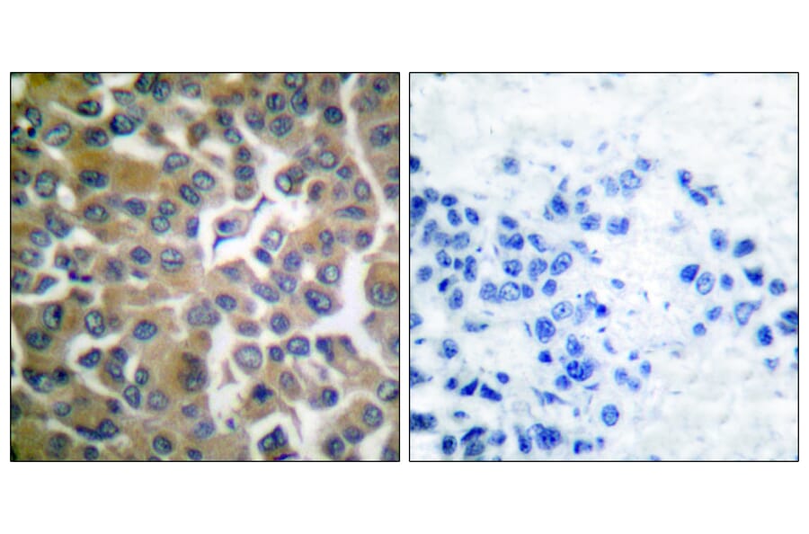 Immunohistochemistry - Anti-FAP-1 Antibody (C0188) - Antibodies.com
