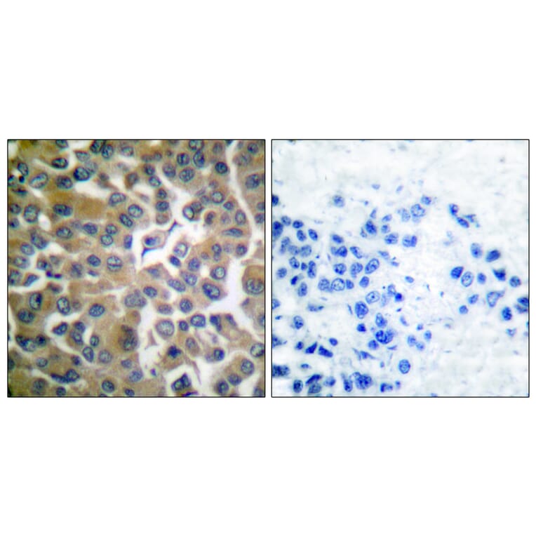Immunohistochemistry - Anti-FAP-1 Antibody (C0188) - Antibodies.com