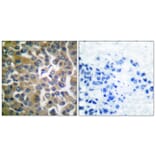 Immunohistochemistry - Anti-FAP-1 Antibody (C0188) - Antibodies.com