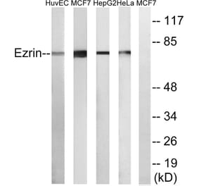 Western Blot - Anti-Ezrin Antibody (C0186) - Antibodies.com