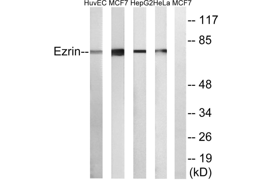 Western Blot - Anti-Ezrin Antibody (C0186) - Antibodies.com
