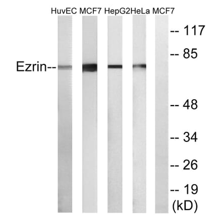 Western Blot - Anti-Ezrin Antibody (C0186) - Antibodies.com