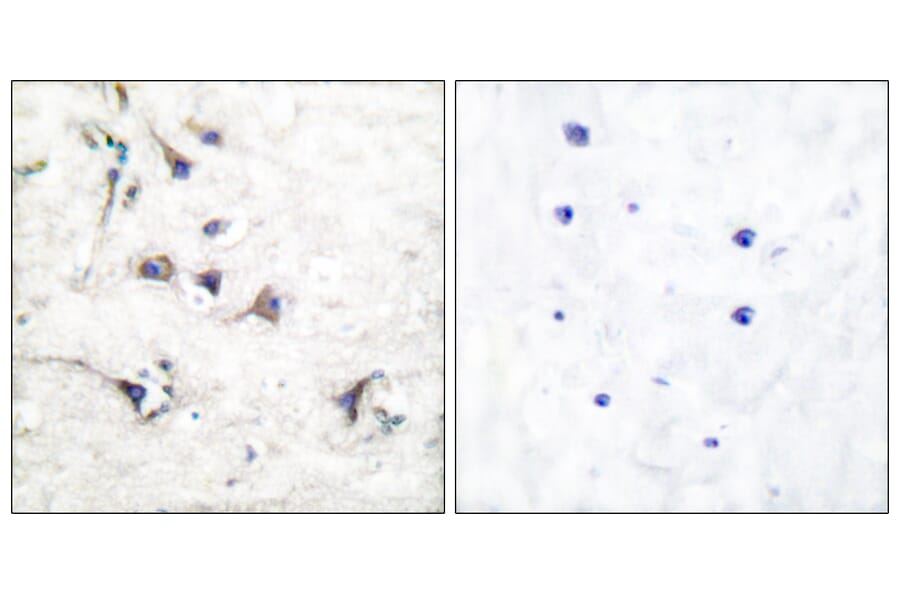 Immunohistochemistry - Anti-Ezrin Antibody (C0186) - Antibodies.com