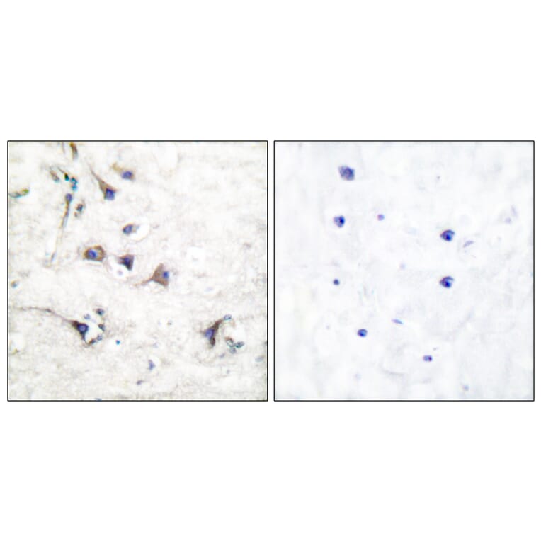 Immunohistochemistry - Anti-Ezrin Antibody (C0186) - Antibodies.com