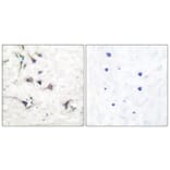 Immunohistochemistry - Anti-Ezrin Antibody (C0186) - Antibodies.com