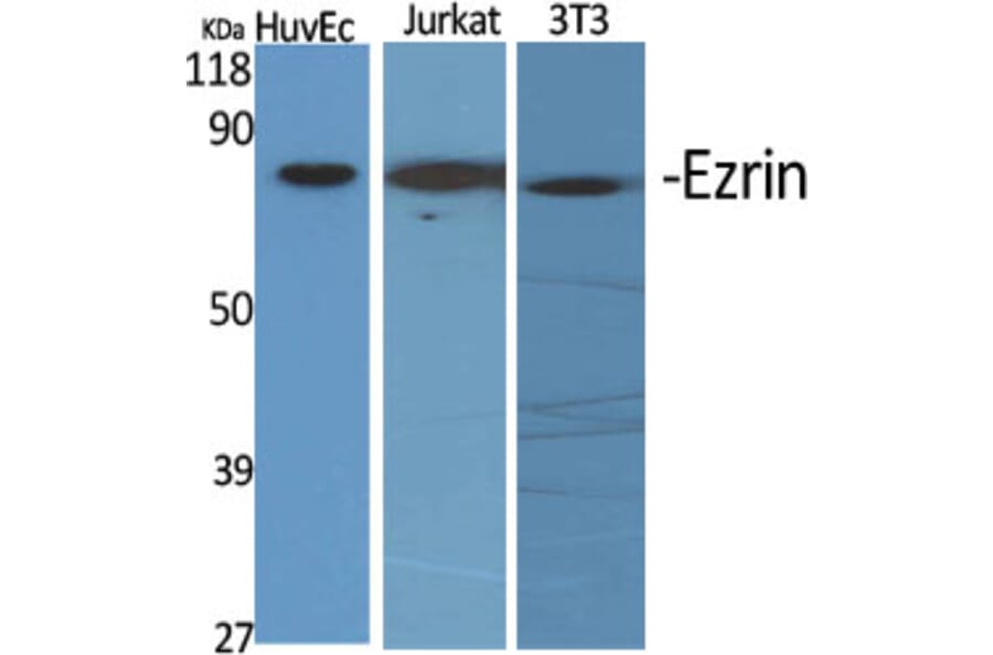 Western Blot - Anti-Ezrin Antibody (C0186) - Antibodies.com