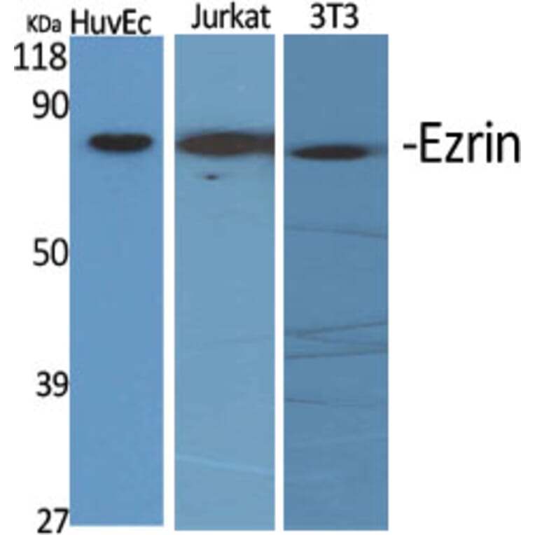 Western Blot - Anti-Ezrin Antibody (C0186) - Antibodies.com