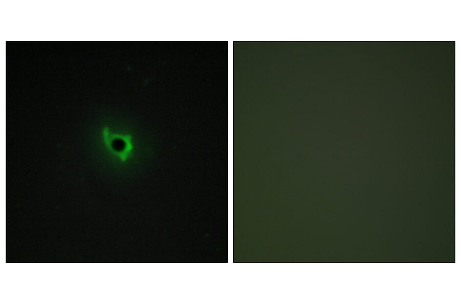 Immunofluorescence - Anti-EPHA6 Antibody (C11829) - Antibodies.com