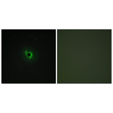 Immunofluorescence - Anti-EPHA6 Antibody (C11829) - Antibodies.com