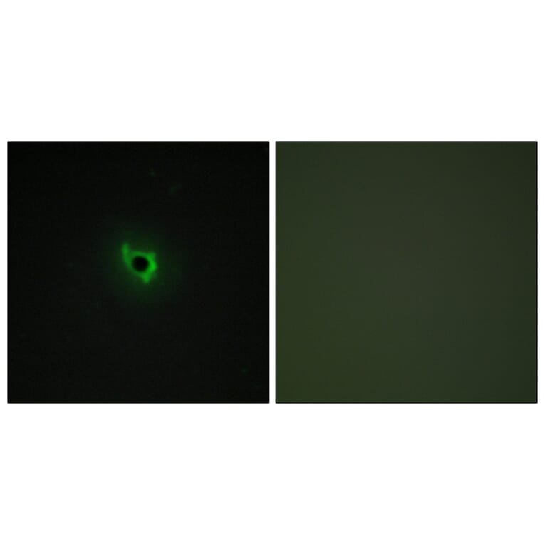 Immunofluorescence - Anti-EPHA6 Antibody (C11829) - Antibodies.com
