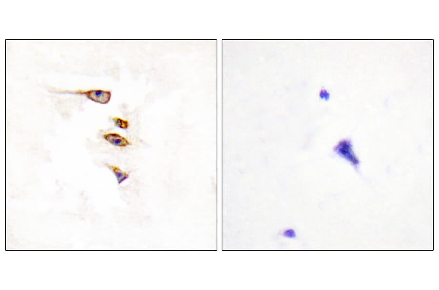 Immunohistochemistry - Anti-EPHA6 Antibody (C11829) - Antibodies.com