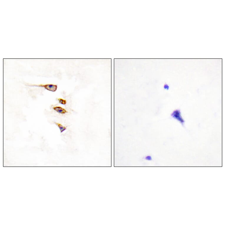 Immunohistochemistry - Anti-EPHA6 Antibody (C11829) - Antibodies.com