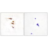 Immunohistochemistry - Anti-EPHA6 Antibody (C11829) - Antibodies.com