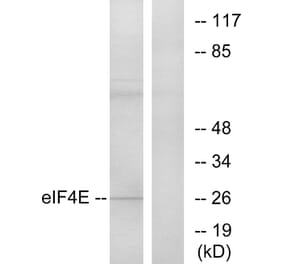 Western Blot - Anti-eIF4E Antibody (B7067) - Antibodies.com