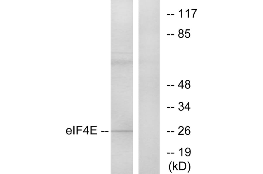 Western Blot - Anti-eIF4E Antibody (B7067) - Antibodies.com