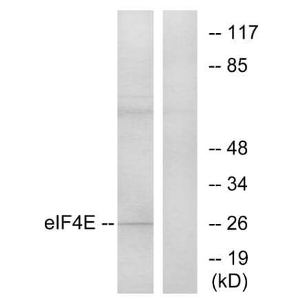 Western Blot - Anti-eIF4E Antibody (B7067) - Antibodies.com