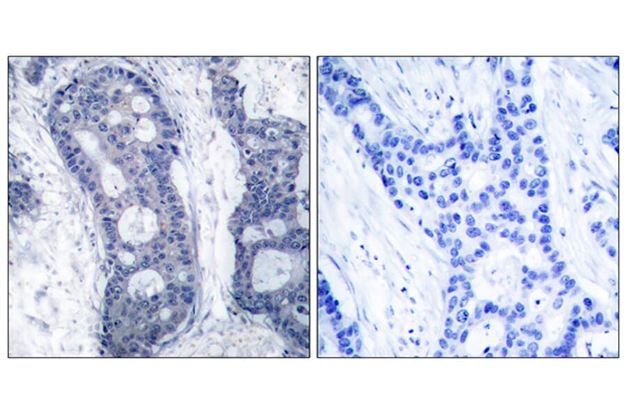 Immunohistochemistry - Anti-eIF4E Antibody (B7067) - Antibodies.com
