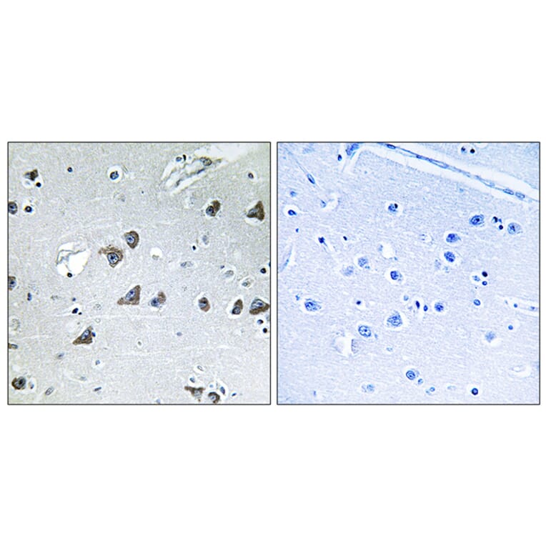 Immunohistochemistry - Anti-EIF3F Antibody (C15711) - Antibodies.com