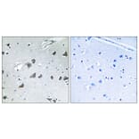 Immunohistochemistry - Anti-EIF3F Antibody (C15711) - Antibodies.com