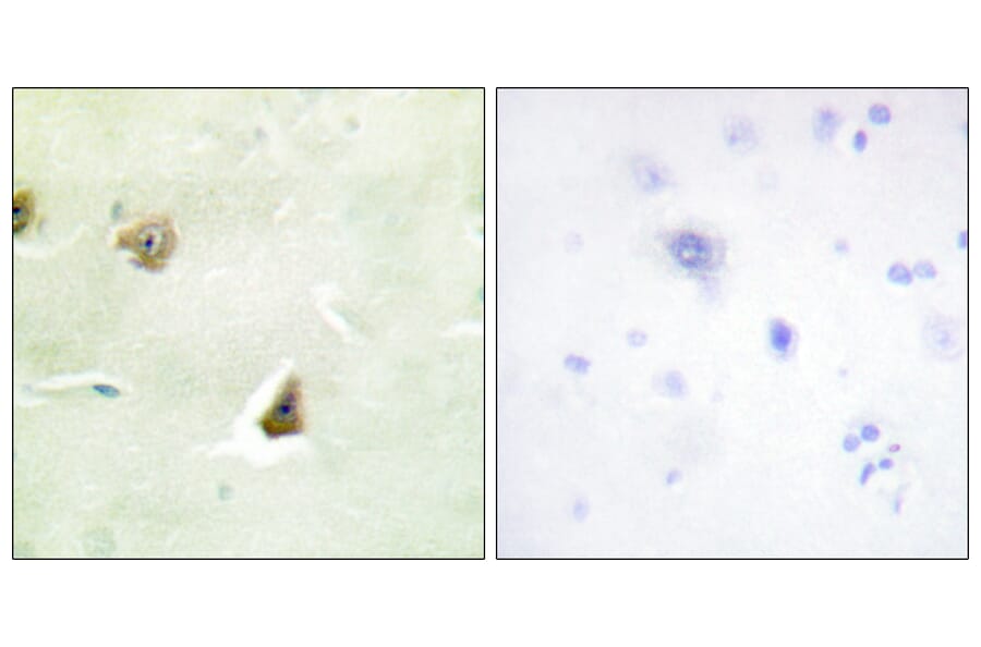 Immunohistochemistry - Anti-DUSP6 Antibody (C11142) - Antibodies.com
