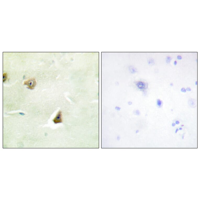 Immunohistochemistry - Anti-DUSP6 Antibody (C11142) - Antibodies.com