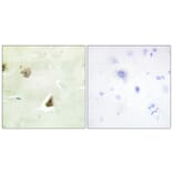 Immunohistochemistry - Anti-DUSP6 Antibody (C11142) - Antibodies.com