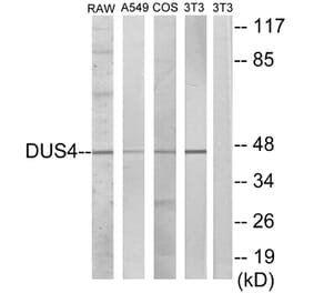 Western Blot - Anti-DUSP4 Antibody (C10947) - Antibodies.com