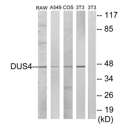 Western Blot - Anti-DUSP4 Antibody (C10947) - Antibodies.com