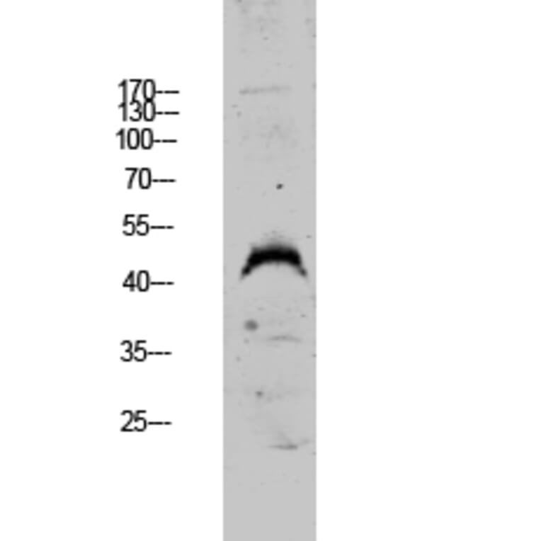 Western Blot - Anti-DUSP4 Antibody (C10947) - Antibodies.com