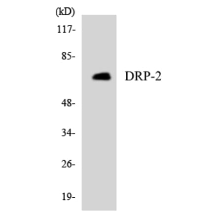Western Blot - Anti-DRP-2 Antibody (R12-2714) - Antibodies.com