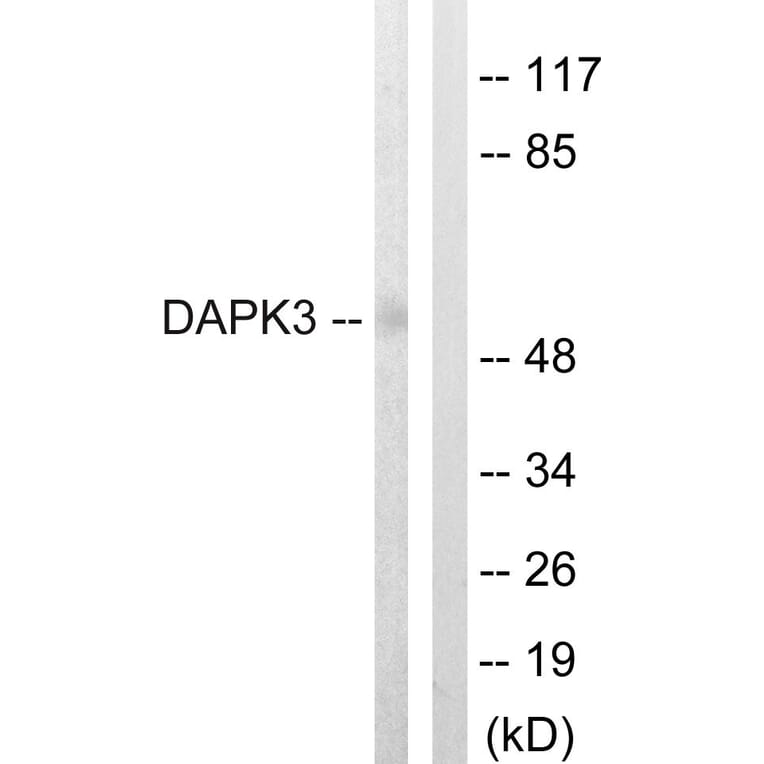 Western Blot - Anti-DAPK3 Antibody (B0900) - Antibodies.com