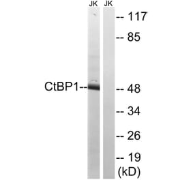 Western Blot - Anti-CtBP1 Antibody (B8325) - Antibodies.com
