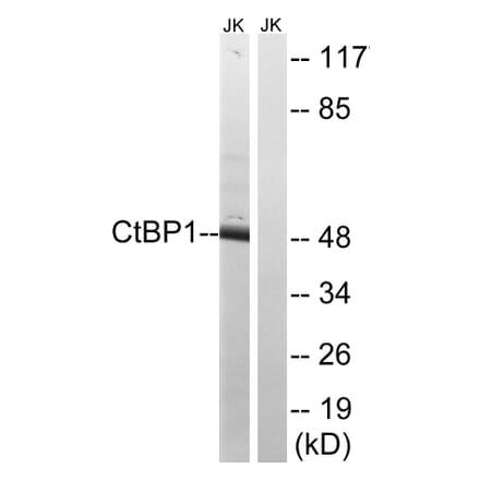 Western Blot - Anti-CtBP1 Antibody (B8325) - Antibodies.com
