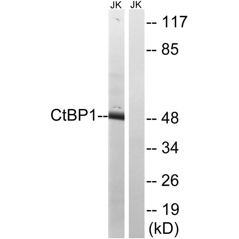 Western Blot - Anti-CtBP1 Antibody (B8325) - Antibodies.com