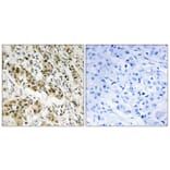 Immunohistochemistry - Anti-CtBP1 Antibody (B8325) - Antibodies.com
