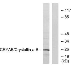 Western Blot - Anti-CRYAB Antibody (B0895) - Antibodies.com