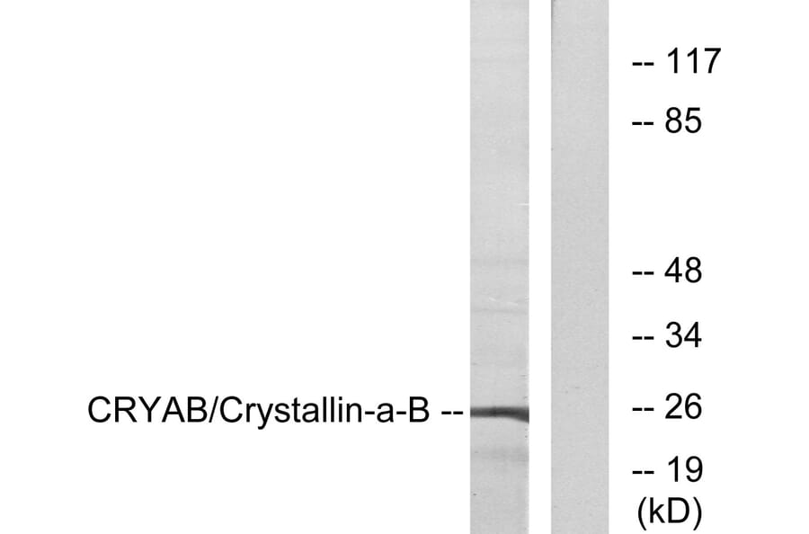 Western Blot - Anti-CRYAB Antibody (B0895) - Antibodies.com