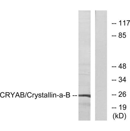 Western Blot - Anti-CRYAB Antibody (B0895) - Antibodies.com