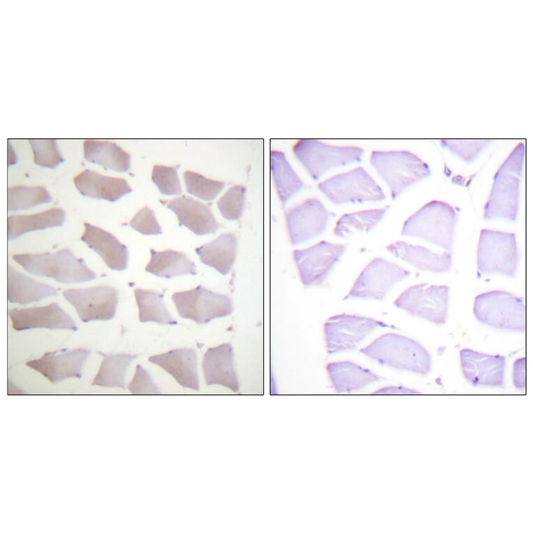 Immunohistochemistry - Anti-CRYAB Antibody (B0895) - Antibodies.com