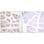 Immunohistochemistry - Anti-CRYAB Antibody (B0895) - Antibodies.com