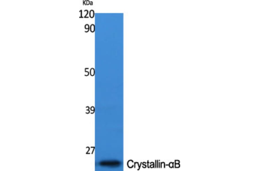 Western Blot - Anti-CRYAB Antibody (B0895) - Antibodies.com
