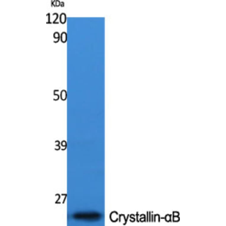 Western Blot - Anti-CRYAB Antibody (B0895) - Antibodies.com