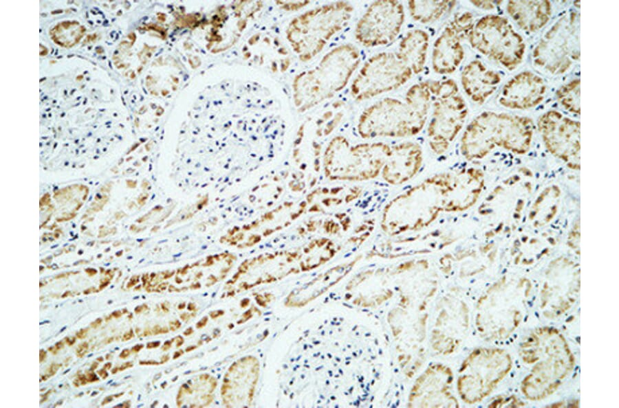 Immunohistochemistry - Anti-CRYAB Antibody (B0895) - Antibodies.com